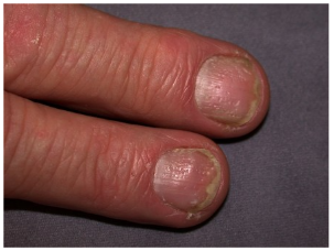 fingernail image